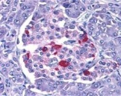 Endo G Antibody - BSA Free, Novus Biologicals 0.1mg; Unlabeled:Antibodies,