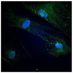 Endoglin/CD105 Antibody (3A9) - BSA Free, Novus Biologicals:Antibodies:Primary