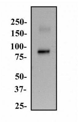 Endoglin/CD105 Antibody (3A9) - BSA Free, Novus Biologicals:Antibodies:Primary