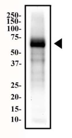 Endoglin/CD105 Antibody (MJ7/18), Novus Biologicals 0.5mg; Unlabeled:Antibodies,