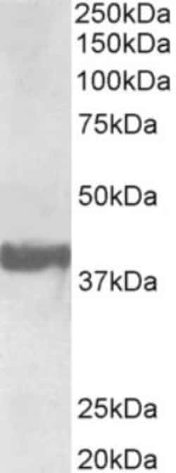 Endophilin A1/SH3GL2 Antibody, Novus Biologicals 0.1mg; Unlabeled:Antibodies,