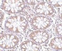 Endosialin/CD248/TEM1 Antibody - BSA Free, Novus Biologicals 0.1mg; Unlabeled:Antibodies,
