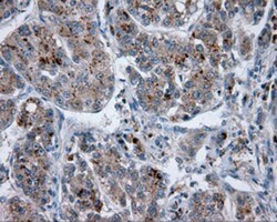 Endothelial Lipase Antibody (OTI1D9), Novus Biologicals 0.1mL; Unlabeled:Antibodies,
