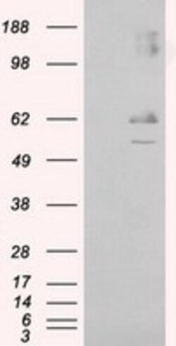 Endothelial Lipase Antibody (OTI1D9), Novus Biologicals 0.1mL; Unlabeled:Antibodies,