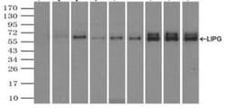Endothelial Lipase Antibody (OTI1D9), Novus Biologicals 0.1mL; Unlabeled:Antibodies,