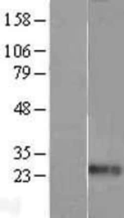 Novus Biologicals&trade;&nbsp;Endothelin-1 Overexpression Lysate