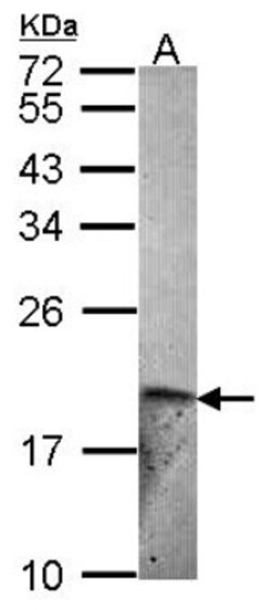 Endothelin 2 Antibody, Novus Biologicals 0.1mL; Unlabeled:Antibodies, Polyclonal