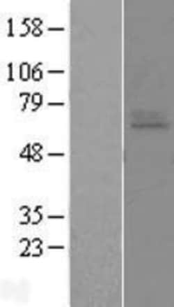 Novus Biologicals&trade;&nbsp;EDNRA/Endothelin R Type A Overexpression Lysate
