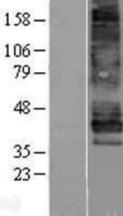 Novus Biologicals™ EDNRB/Endothelin R Type B Overexpression Lysate