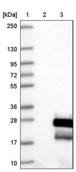Endothelin 2 Antibody, Novus Biologicals 25 &mu;L; Unlabeled:Antibodies,