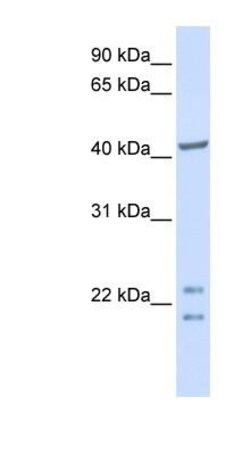 ENKD1 Antibody, Novus Biologicals 100&mu;L; Unlabeled:Antibodies, Polyclonal