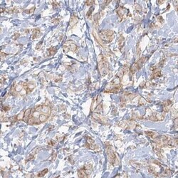 enkurin Antibody, Novus Biologicals 25 &mu;L | Buy Online | Novus Biologicals | Fisher Scientific