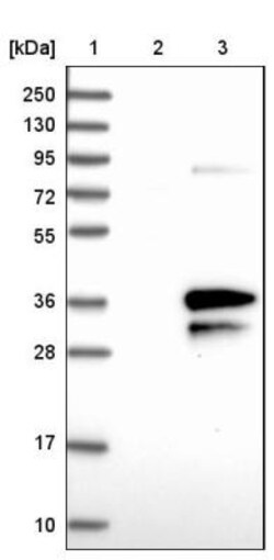 enkurin Antibody, Novus Biologicals:Antibodies:Primary Antibodies