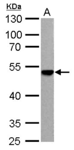 ENO3 Antibody, Novus Biologicals 0.1mL; Unlabeled:Antibodies, Polyclonal