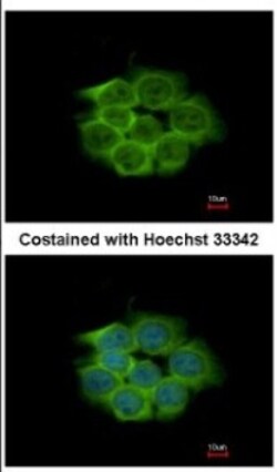 Enolase 1 Antibody, Novus Biologicals 0.1mL; Unlabeled:Antibodies, Polyclonal