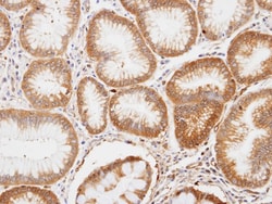 Enolase 1 Antibody, Novus Biologicals 0.1mg; Unlabeled:Antibodies, Polyclonal
