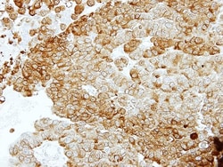 Enolase 2/Neuron-specific Enolase Antibody, Novus Biologicals 0.1mL; Unlabeled:Antibodies,