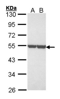 Enolase 1 Antibody, Novus Biologicals 0.1mg; Unlabeled:Antibodies, Polyclonal