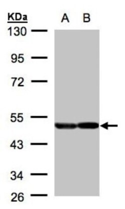 Enolase 2/Neuron-specific Enolase Antibody, Novus Biologicals 0.1mL; Unlabeled:Antibodies,