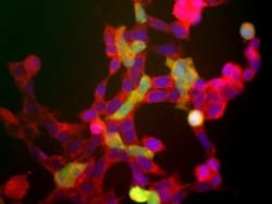 Enolase 2/Neuron-specific Enolase Antibody, Novus Biologicals 0.1mL; Unlabeled:Antibodies,