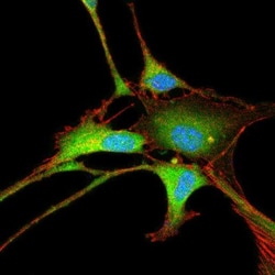 Enolase 2/Neuron-specific Enolase Antibody, Novus Biologicals 0.1mL; Unlabeled:Antibodies,