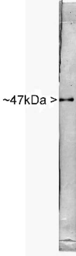 Enolase 2/Neuron-specific Enolase Antibody, Novus Biologicals 0.1mL; Unlabeled:Antibodies,