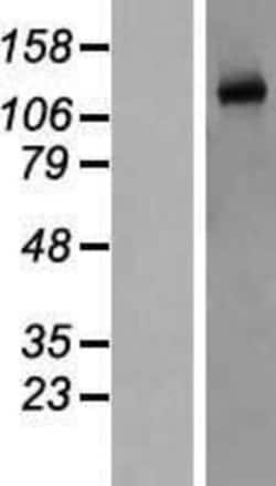 Novus Biologicals&trade;&nbsp;eNOS Overexpression Lysate