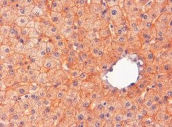 ENPP-1 Antibody, Novus Biologicals 0.1mg; Unlabeled:Antikörper