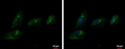 ENPP-2/Autotaxin Antibody, Novus Biologicals 0.1mL; Unlabeled:Antibodies,