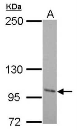 ENPP-2/Autotaxin Antibody, Novus Biologicals 0.1mL; Unlabeled:Antibodies,