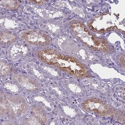 ENPP6 Antibody, Novus Biologicals 0.1mL; Unlabeled:Antibodies, Polyclonal