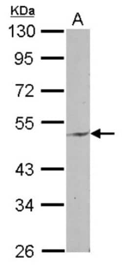 ENPP6 Antibody, Novus Biologicals 0.1mL; Unlabeled:Antibodies, Polyclonal