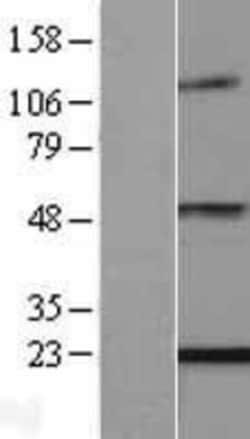 Novus Biologicals&trade;&nbsp;ENPP6 Overexpression Lysate