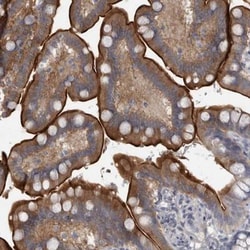 ENPP-7/Alk-SMase Antibody, Novus Biologicals 0.1mL; Unlabeled:Antibodies,