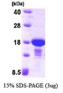 Novus Biologicals&trade;&nbsp;Recombinant Human alpha Endosulfine His Protein
