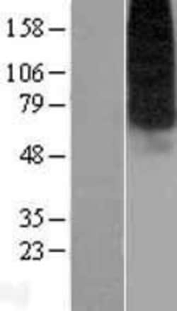 Novus Biologicals&trade;&nbsp;ENT1 Overexpression Lysate