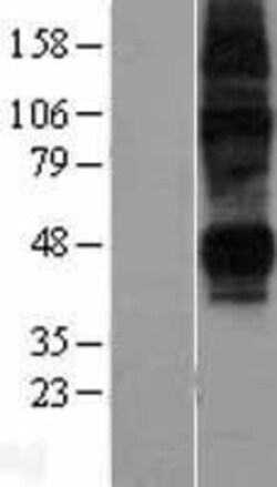 Novus Biologicals&trade;&nbsp;ENT2 Overexpression Lysate