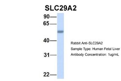 ENT2 Antibody, Novus Biologicals 0.05mg; Unlabeled:Antibodies, Polyclonal
