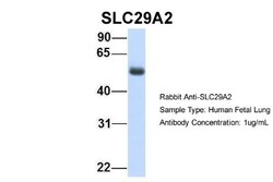 ENT2 Antibody, Novus Biologicals 0.05mg; Unlabeled:Antibodies, Polyclonal