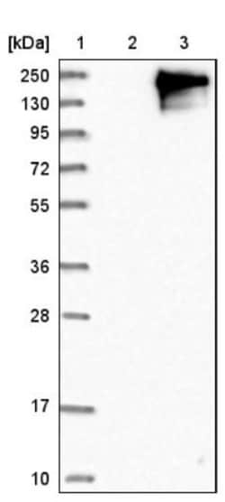 Enteropeptidase/Enterokinase Antibody, Novus Biologicals 0.1mL; Unlabeled:Antibodies,