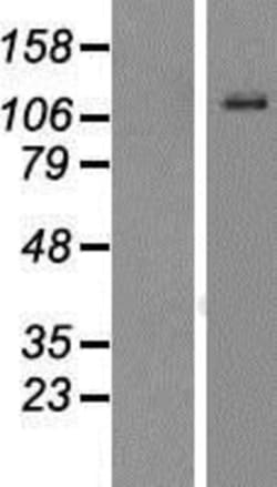 R&D Systems&trade;&nbsp;Enteropeptidase/Enterokinase Overexpression Lysate