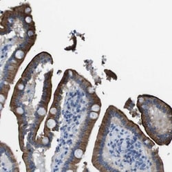 Enteropeptidase/Enterokinase Antibody, Novus Biologicals 0.1mL; Unlabeled:Antibodies,