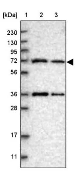 ENTHD1 Antibody, Novus Biologicals 25 &mu;L | Buy Online | Novus Biologicals | Fisher Scientific