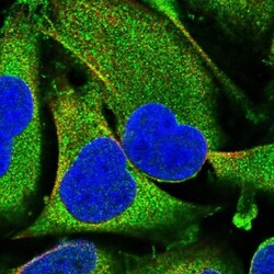 ENTHD1 Antibody, Novus Biologicals 25 &mu;L | Buy Online | Novus Biologicals | Fisher Scientific