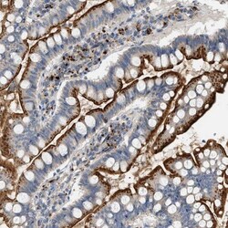 ENTHD1 Antibody, Novus Biologicals 25 &mu;L | Buy Online | Novus Biologicals | Fisher Scientific