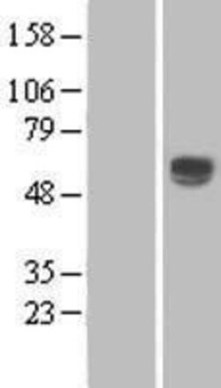Novus Biologicals&trade;&nbsp;CD39L1/ENTPD2 Overexpression Lysate