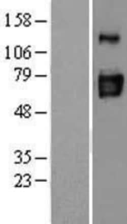 Novus Biologicals&trade;&nbsp;CD39L3/ENTPD3 Overexpression Lysate