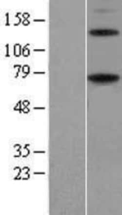 Novus Biologicals&trade;&nbsp;ENTPD4 Overexpression Lysate