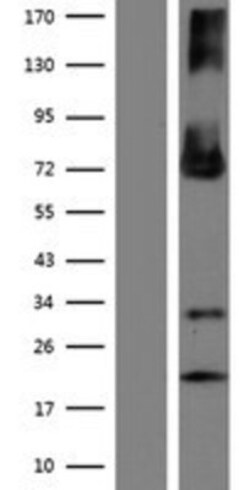 Novus Biologicals&trade;&nbsp;ENTPD4 Overexpression Lysate