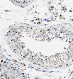 ENTPD4 Antibody, Novus Biologicals 25 &mu;L; Unlabeled:Antibodies, Polyclonal